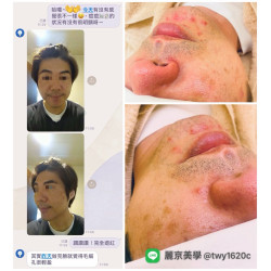 麗京美學 蘆洲臉部保養・清粉刺專業調理