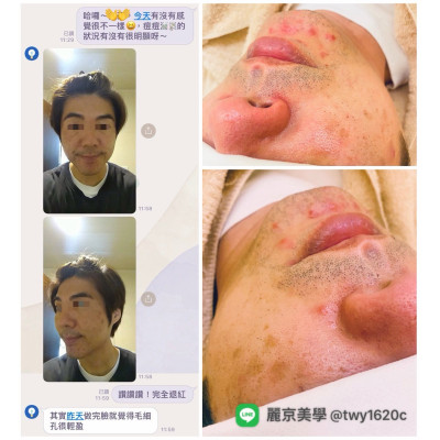 麗京美學 蘆洲臉部保養・清粉刺專業調理