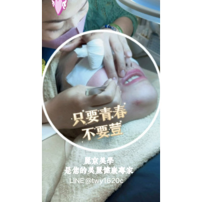 只要青春 不要荳 2026暑期學生肌膚保養專案
